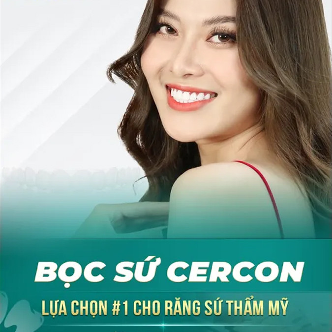 Răng sứ Cercon giá bao nhiêu? Ưu đãi tháng 3 – Giảm đến 50%