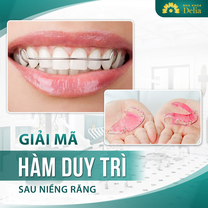[Cập Nhật Giá] 3 loại hàm duy trì sau niềng răng được dùng phổ biến nhất