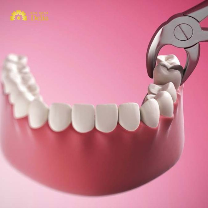 Top 10+ Nha khoa nhổ răng khôn giá rẻ ở đâu tphcm tốt nhất