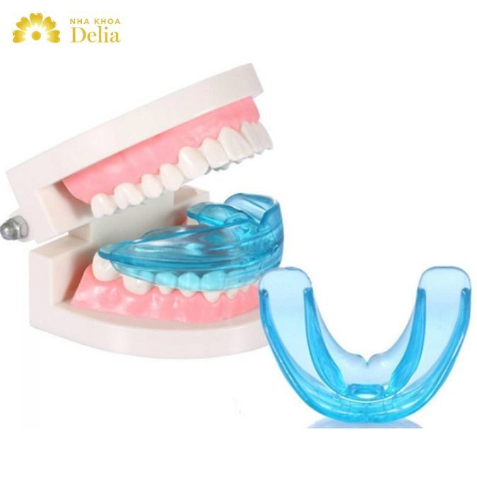 Niềng răng silicon có thật sự hiệu quả? Đâu là giải pháp niềng răng tối ưu nhất?