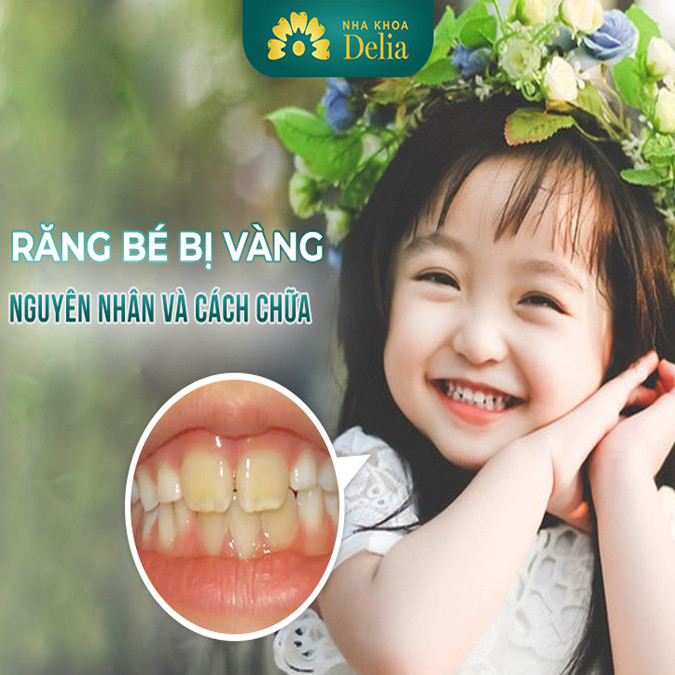 Răng bé bị vàng mòn phải làm sao? Cách khắc phục hiệu quả nhất
