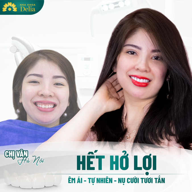 Cắt lợi có mọc lại không? Trường hợp nào phải cắt lợi ngay lập tức