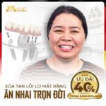 Tại sao phải trồng răng Implant