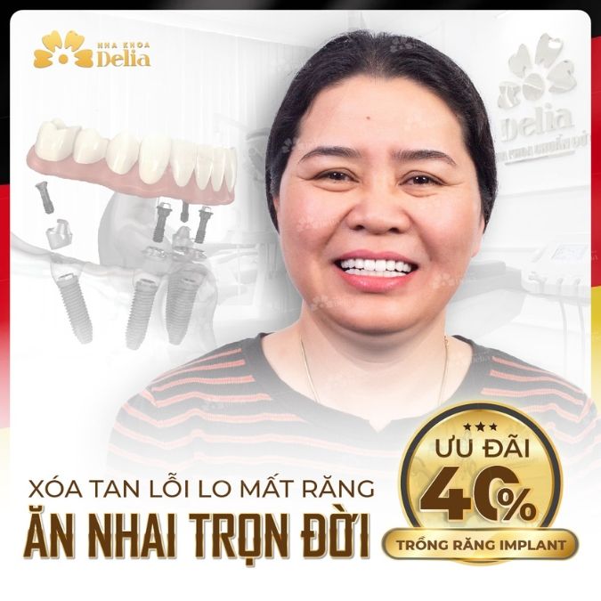 Tại sao phải trồng răng implant? Đánh giá ưu nhược điểm