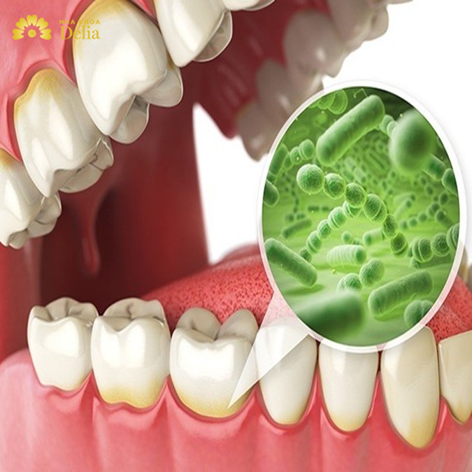 Bệnh viêm nha chu – Nguyên nhân và cách khắc phục triệt để nhanh nhất