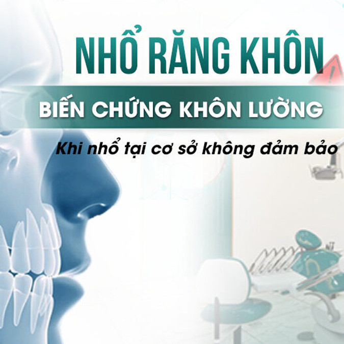 Biến chứng sau khi nhổ răng khôn? Nhổ sai kỹ thuật hậu quả khó lường