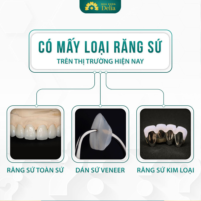 Các loại răng sứ tốt nhất hiện nay, nên chọn răng sứ loại nào?