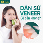 phủ răng sứ thẩm mỹ