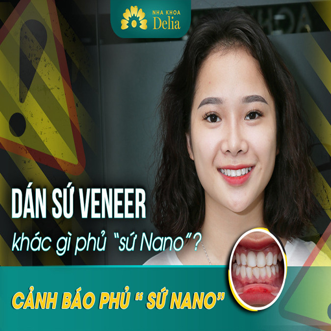 Phủ sứ và dán sứ có gì khác nhau? phân biệt phủ sứ nano và dán sứ veneer