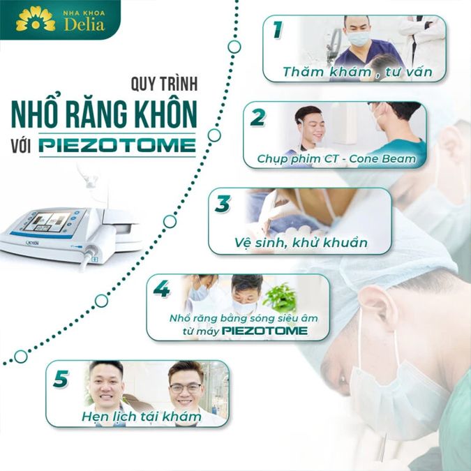 Nhổ răng khôn không đau?- Thực hư công nghệ siêu âm Piezotome