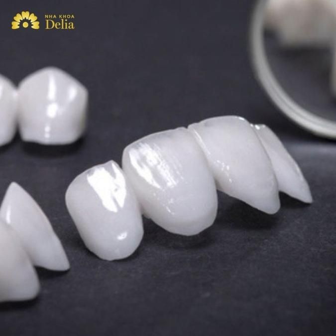 Thẻ bảo hành răng sứ Venus được bảo hành như thế nào?