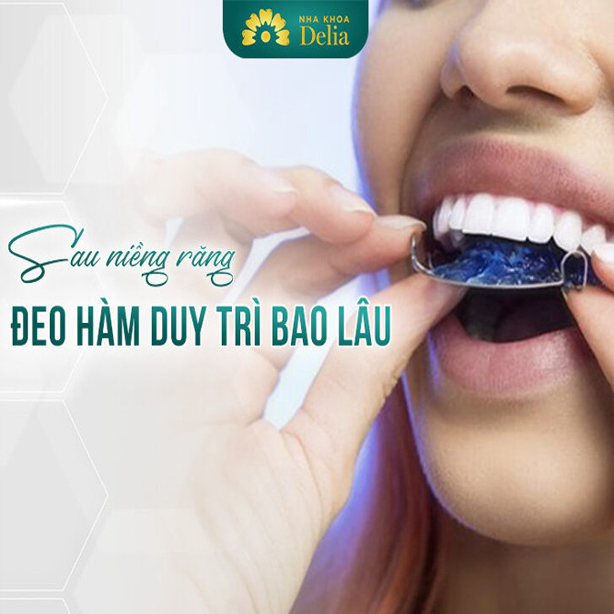 Cần đeo hàm duy trì sau niềng răng bao lâu? Nha khoa Delia