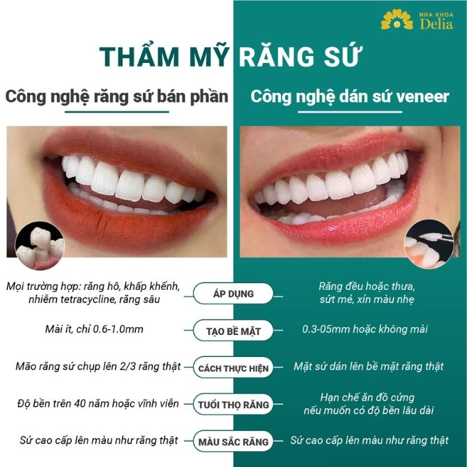 Bọc răng sứ hay dán sứ veneer, đâu là phương pháp phù hợp nhất?