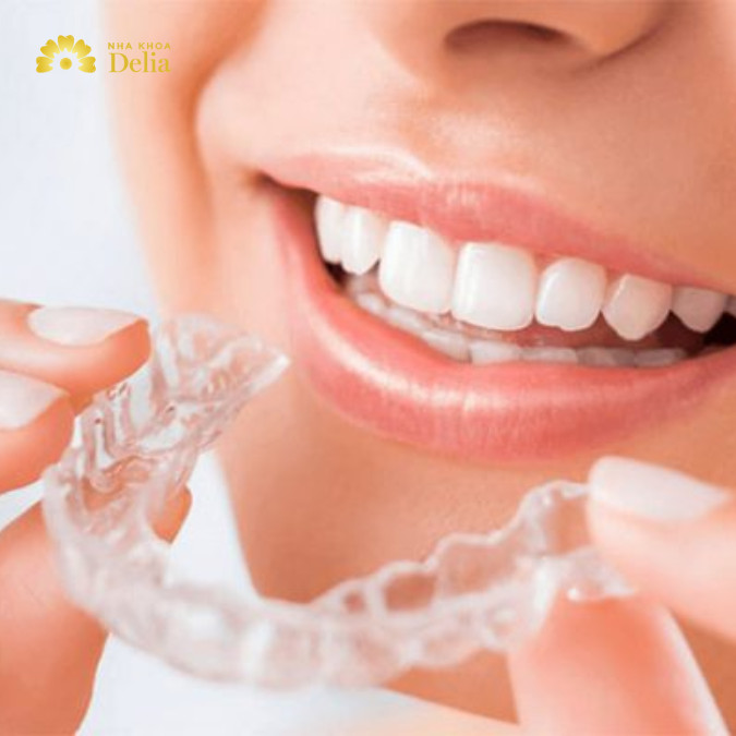 5 Ưu điểm vượt trội hàm duy trì trong suốt – Nha khoa Delia