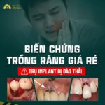 hậu quả của việc cắm trụ implant