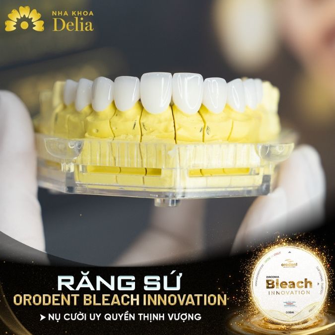 Răng sứ Orodent có tốt không? Giảm giá đến 50% trong tháng 3/2025