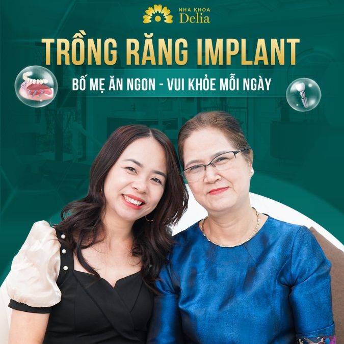 Ưu điểm công nghệ trồng răng Implant tại nha khoa Delia