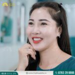 Khách hàng Ngọc Huyền thẩm mỹ răng sứ tại nha khoa Delia