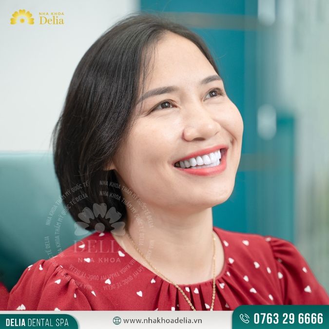 Bọc răng sứ HT Smile khắc phục răng ngả đen – Chị Trịnh Huyền
