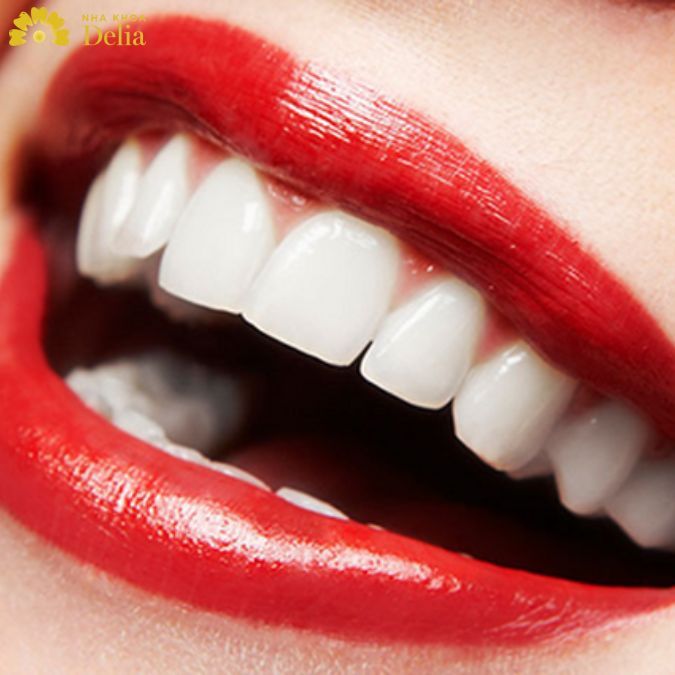 Tìm hiểu những trường hợp nên bọc răng sứ bạn cần biết