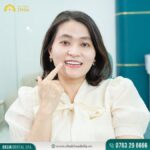 Răng sứ 3 triệu