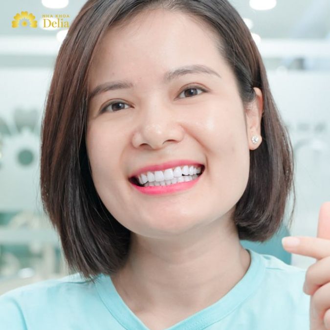 Răng sứ Lava Plus, Esthetic Giảm đến 50% chỉ tháng 3/2025