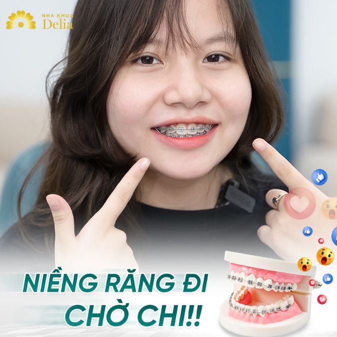 Giải đáp thắc mắc: Dán sứ Veneer có niềng răng được không?