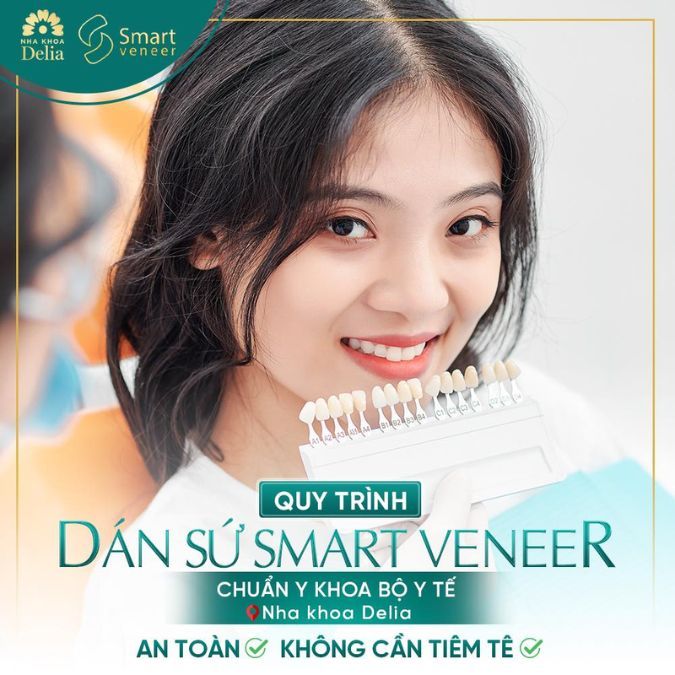 Dán răng sứ Veneer có tốt không? Ưu điểm và nhược điểm của dán răng sứ