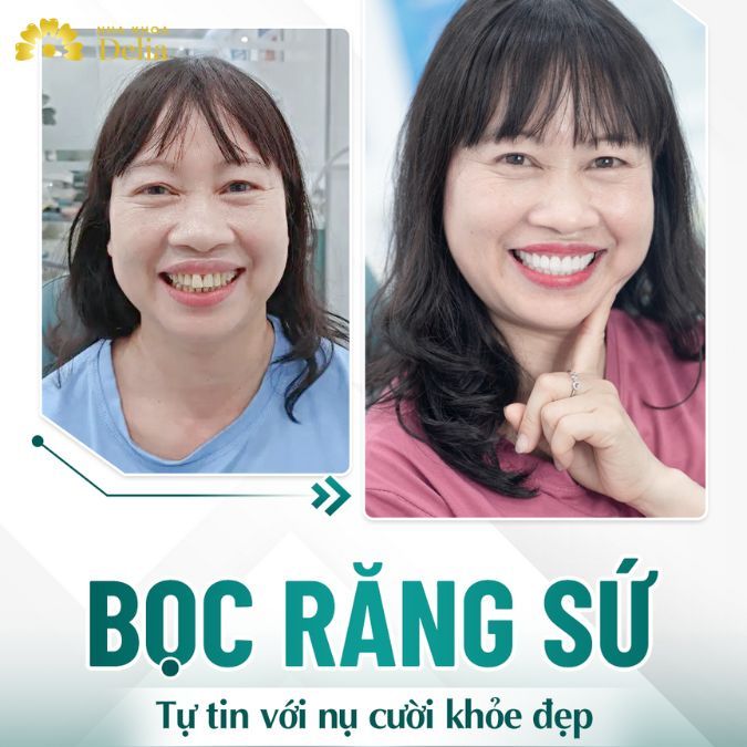Quyết tâm thay đổi diện mạo của Việt kiều Huyền Phương tại nha khoa Delia
