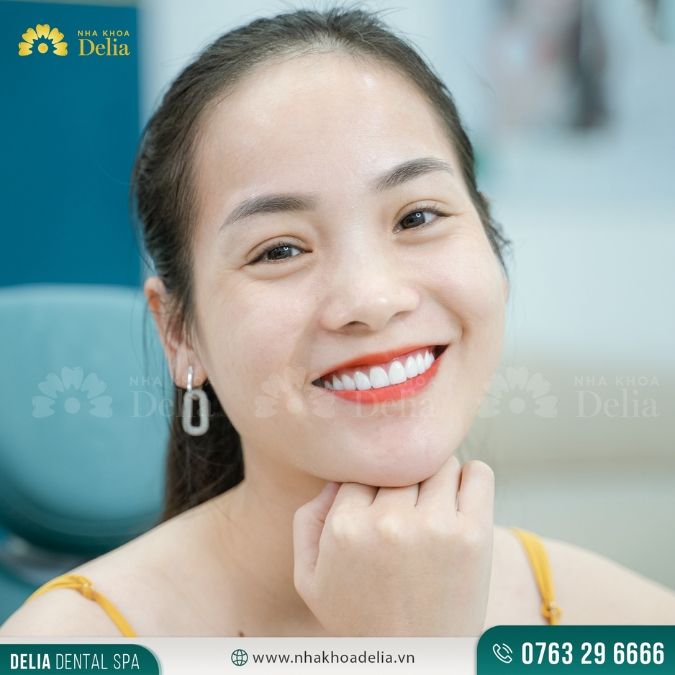 #Câu chuyện khách hàng: Nguyễn Thị Ánh – Thẩm mỹ 18 răng sứ Emax