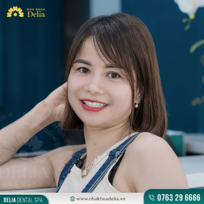 #Câu chuyện khách hàng: Nguyễn Thị Tình thẩm mỹ 18 răng sứ Emax