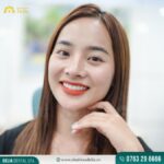 khách hàng vân nguyễn thẩm mỹ răng sứ lava esthetic