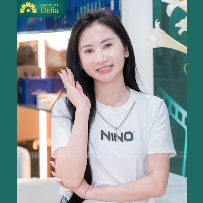 #Câu chuyện khách hàng: Thanh Huyền – Bọc 19 răng sứ HT Smile