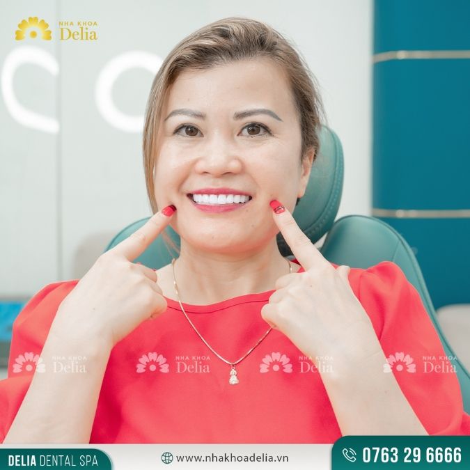 #Câu chuyện khách hàng: Kiều bào Mỹ Trần Hoa thẩm mỹ 20 răng sứ Nacera Q3 Burn