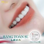 màu răng sứ