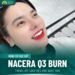 Răng sứ ngọc trai