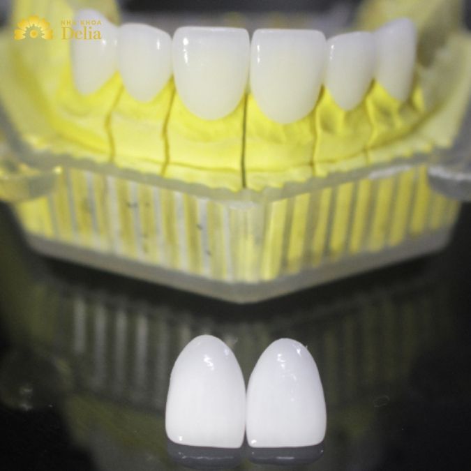 Porcelain crowns vs Zirconia: Which is the best choice for you?