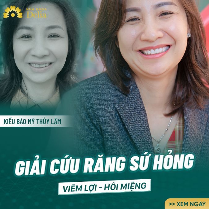 Hành trình tìm lại nụ cười khỏe đẹp sau khi làm răng sứ hỏng của chị Thúy Lâm