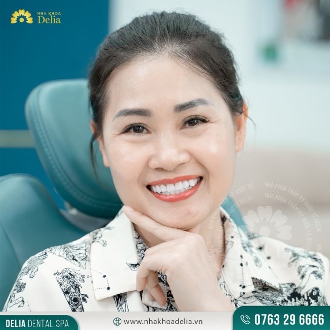 Trồng răng nanh Implant – Phương pháp trồng răng nanh hiện đại nhất hiện nay