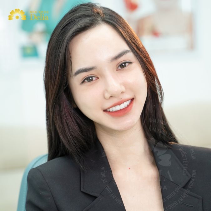 99+ Cách chụp ảnh selfie cho nam, nữ hotrend nhất 2024