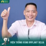Case thực tế các khách hàng trồng răng thành công tại Delia