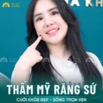 Răng sứ Ceramill - Hoàn thiện vẻ đẹp chuẩn mực cho hot girl xứ Thanh