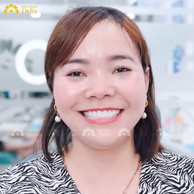 Anh chồng tặng vợ nụ cười răng sứ và cái kết mỹ mãn – Chị Hồ Ngân