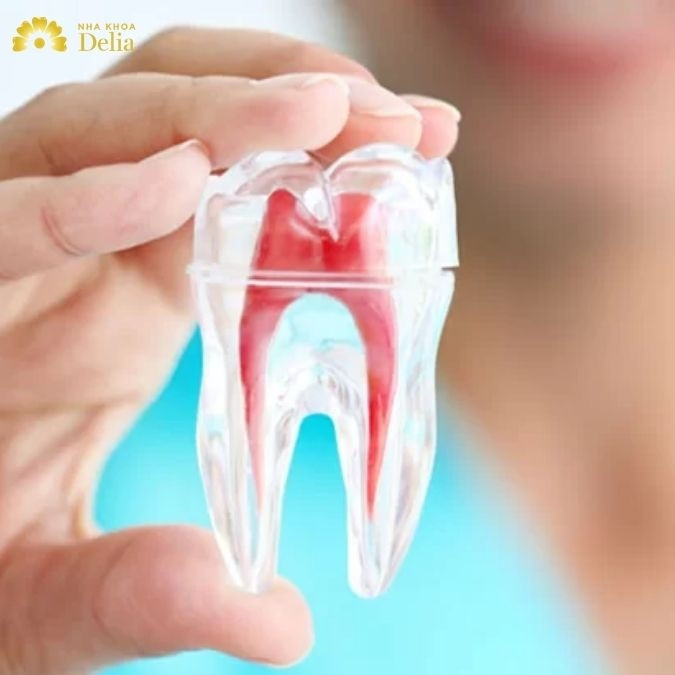 Răng lấy tủy có bị tiêu xương không? Tại sao phải lấy tủy răng?