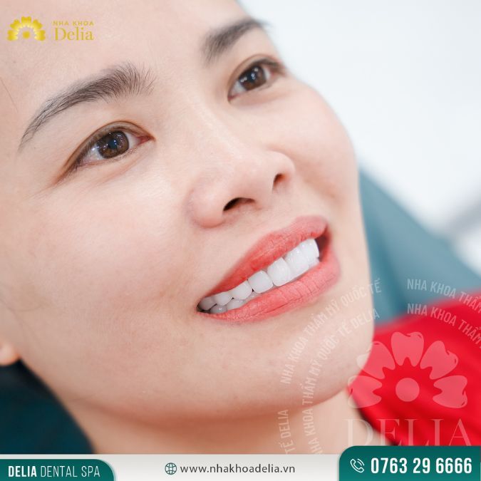 Răng mọc lệch vào trong có nguy hiểm? Biện pháp nào cải thiện tốt nhất?