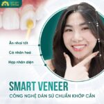 Chỉ sau 48 giờ bạn đã có một hàm răng đẹp, tự nhiên và ấn tượng nhất nhờ dán sứ Smart Veneer