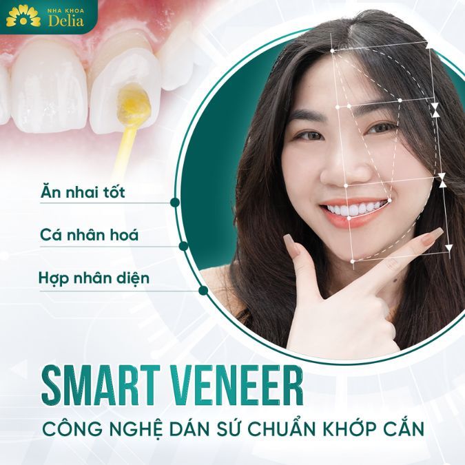 Công nghệ dán sứ Smart Smile Veneers: Giá cả, ưu nhược điểm