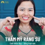 Răng sứ Ceramill - Người hùng giải cứu hàm răng sứ hỏng của chị Triệu Lan