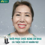 Trồng răng implant Đà Nẵng