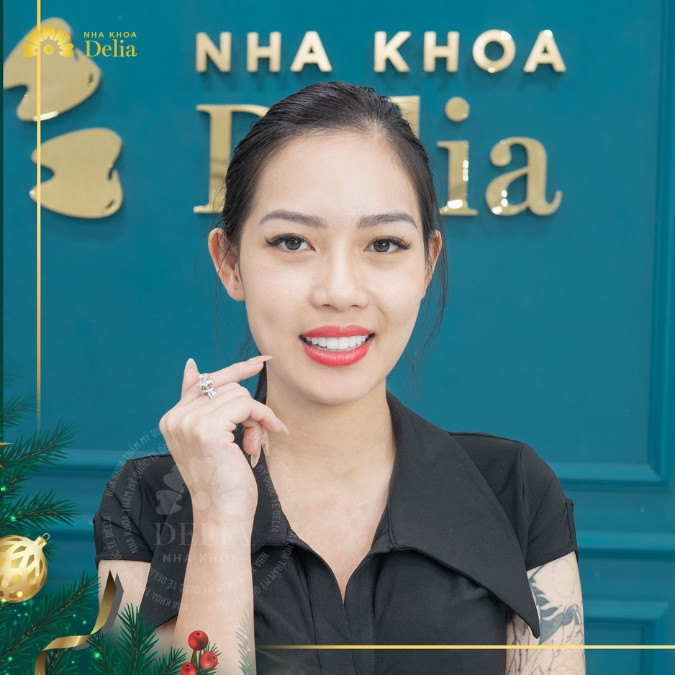 15+ Địa chỉ trồng răng Implant ở Bình Dương uy tín nhất